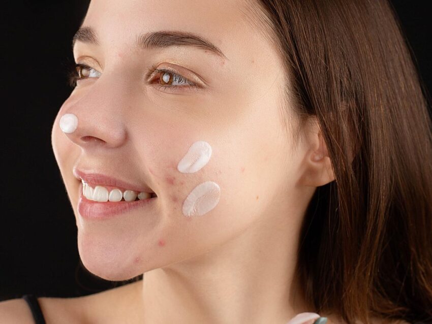 Skin care for oily and acne-prone skin