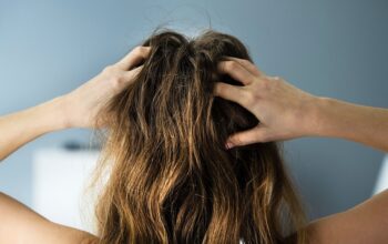 How do you get dandruff flakes out of natural hair?
