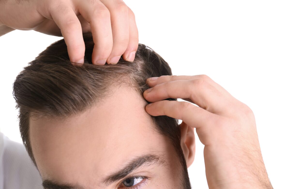 Hair Loss SOS! Myth or Miracle: Can You Really Regrow Your Mane?