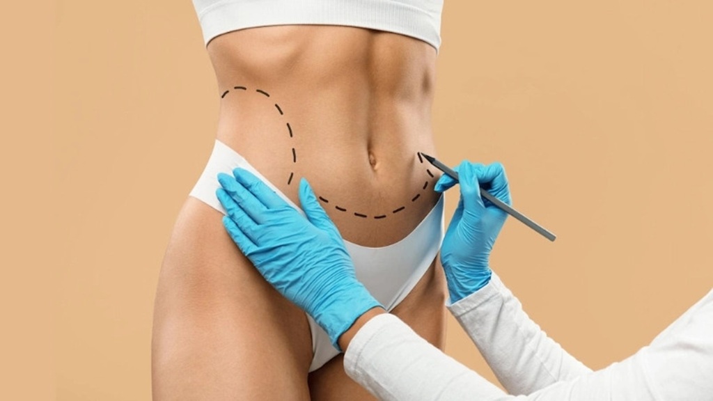 Turkey Tummy Tucks: Safety, Risks, and What You Need to Know + FAQs